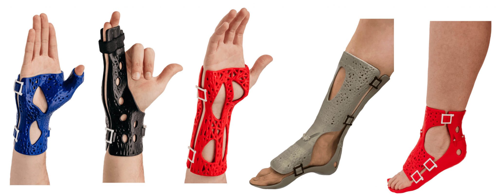 The Advantages of a 3D Printed Cast (Orthopedic Casts) Tutorial45